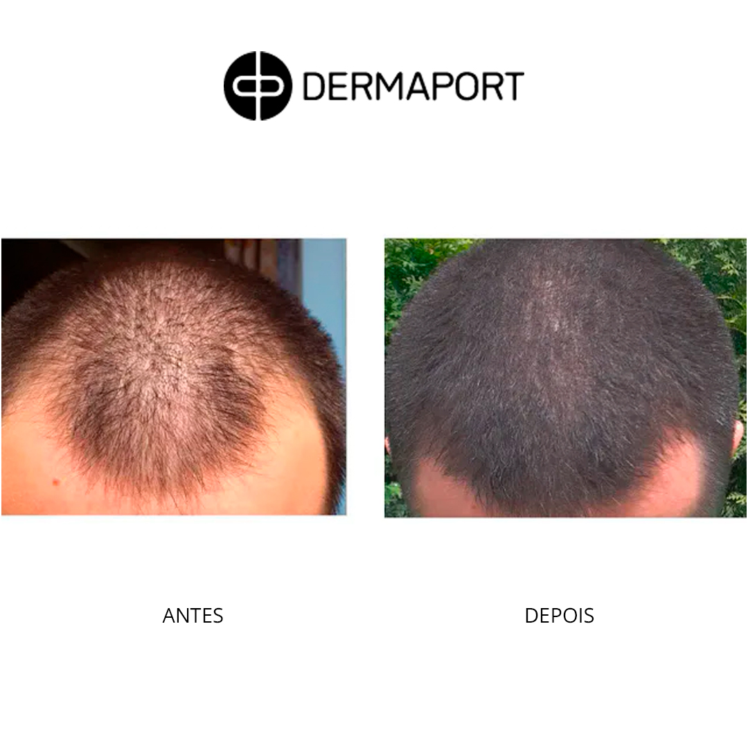 dermaport-ad2