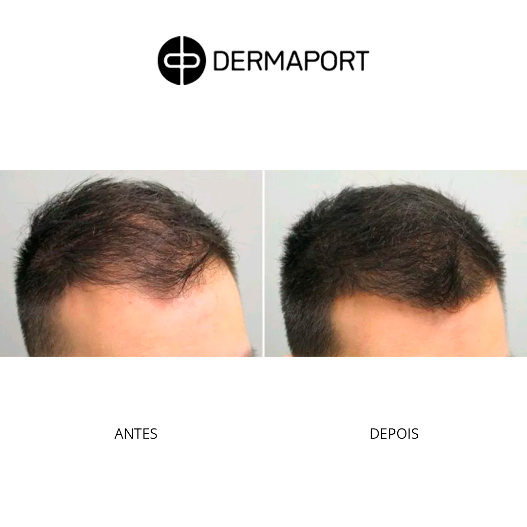 dermaport-ad3